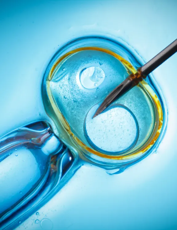 IVF & Embryo Transfer